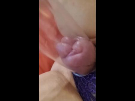 Extreme Clit Pumping Free Sex Videos Watch Beautiful And Exciting