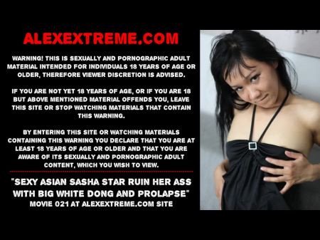 Extreme Insertion Head Inside Ass Free Sex Videos Watch Beautiful And